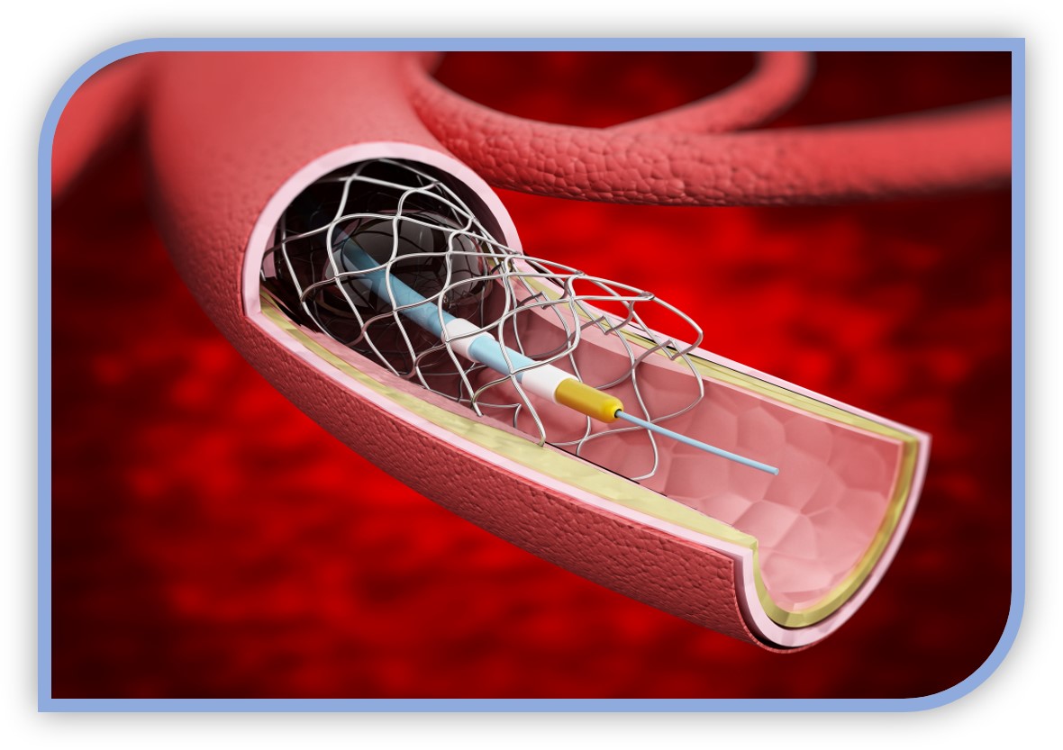 Medical Device Industry